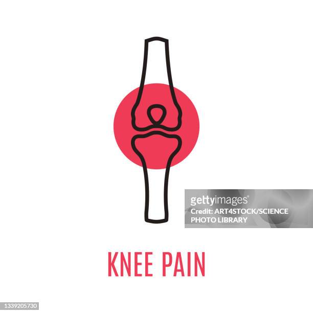 ilustraciones, imágenes clip art, dibujos animados e iconos de stock de knee pain, conceptual illustration - knee