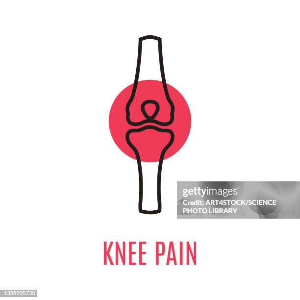 illustrations, cliparts, dessins animés et icônes de knee pain, conceptual illustration - arthrite