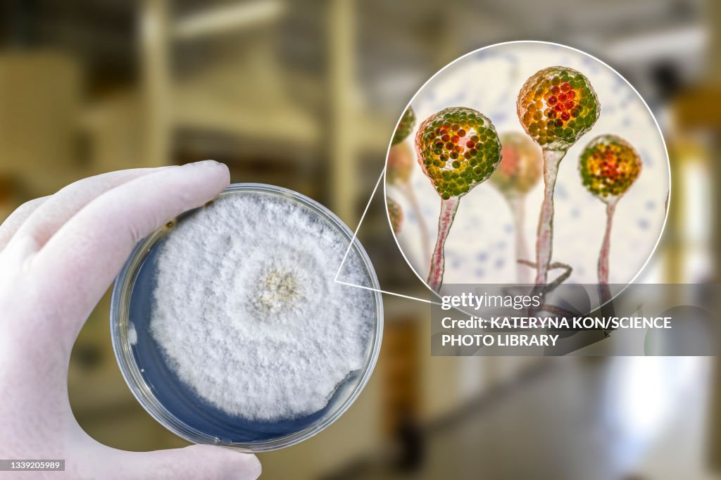 Pin mould (Mucor sp.), composite image