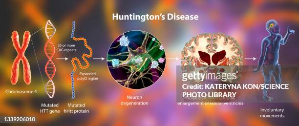 stockillustraties, clipart, cartoons en iconen met molecular genesis of huntington's disease, illustration - coronaal doorsnede
