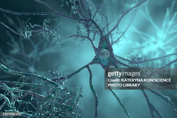 nerve cells affected by alzheimer's disease, illustration - microglia stock illustrations