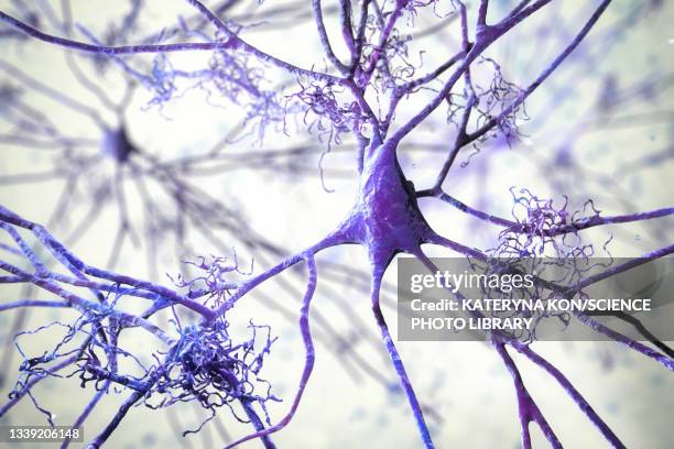 nerve cells affected by alzheimer's disease, illustration - nervenzelle stock-grafiken, -clipart, -cartoons und -symbole