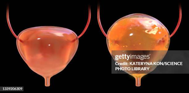Build A Bladder Full Bladder Photos and Premium High Res Pictures - Getty Images