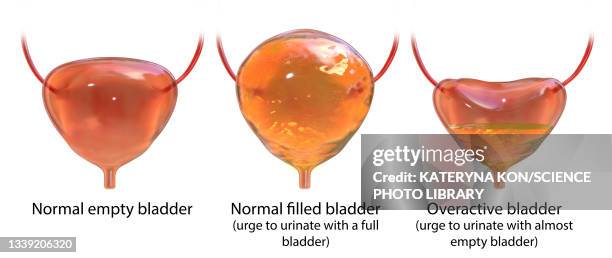 overactive bladder, illustration - bladder stock illustrations