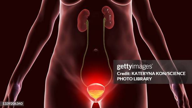 stockillustraties, clipart, cartoons en iconen met cystitis, conceptual illustration - blaas urinewegstelsel