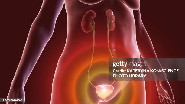 overactive bladder, illustration - overactive bladder stock illustrations