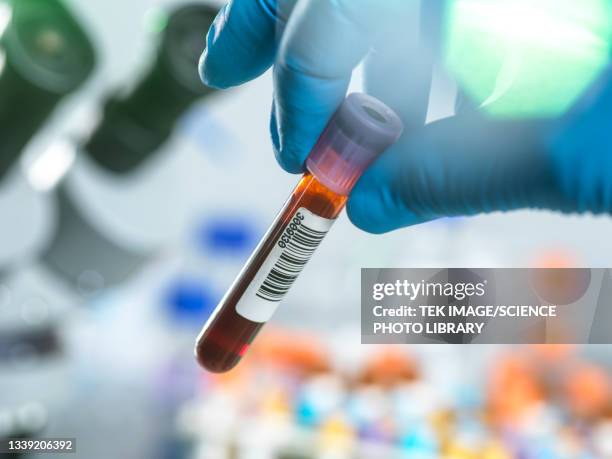 medical testing - blood photos et images de collection