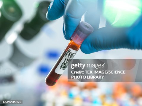 Medical testing Medical testing