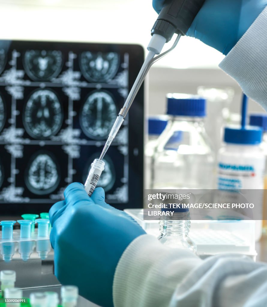 Alzheimers and dementia research