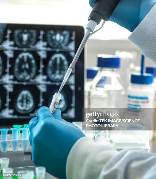 Alzheimers And Dementia Research High-Res Stock Photo
