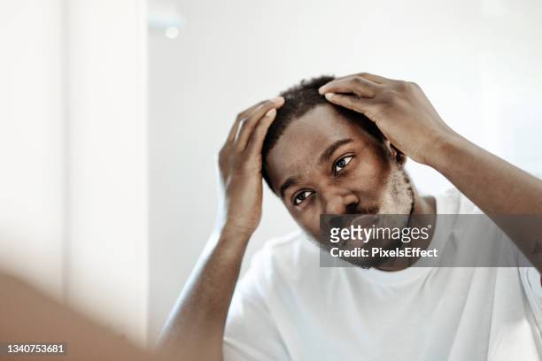 male problem of losing hair - balding stock pictures, royalty-free photos & images
