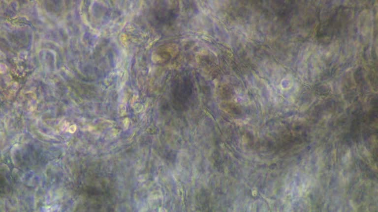 Capillary Microscope Views 48 Micrograph Capillary Stock Videos, Footage, & 4K Video Clips - Getty ...
