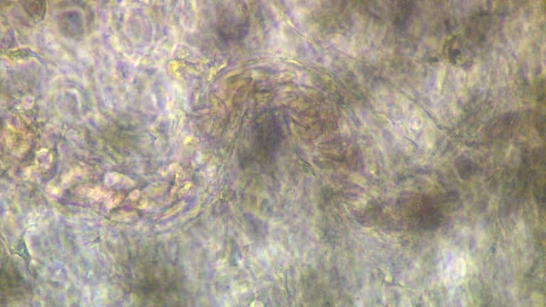 Capillary Microscope Views 48 Micrograph Capillary Stock Videos, Footage, & 4K Video Clips - Getty ...
