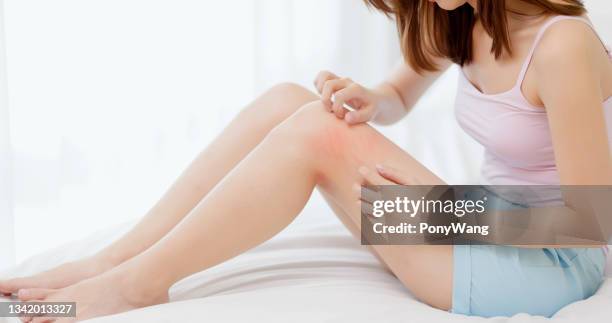 mujer rascándose las piernas - woman cross legs fotografías e imágenes de stock