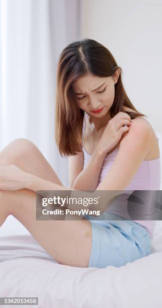 woman scratching her arms - dry skin stock pictures, royalty-free photos & images