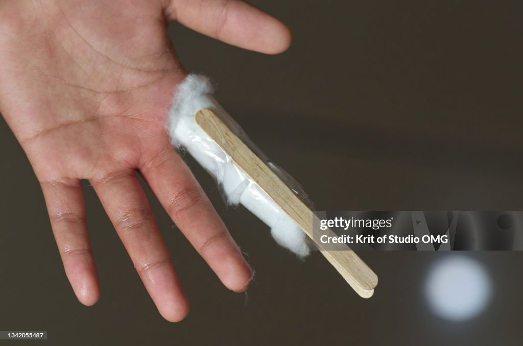 The homemade soft splint broken finger