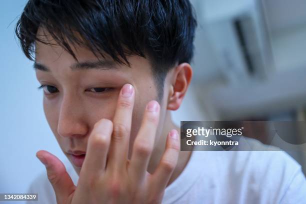 portrait of young man take care of his skin - hordeolum stockfoto's en -beelden