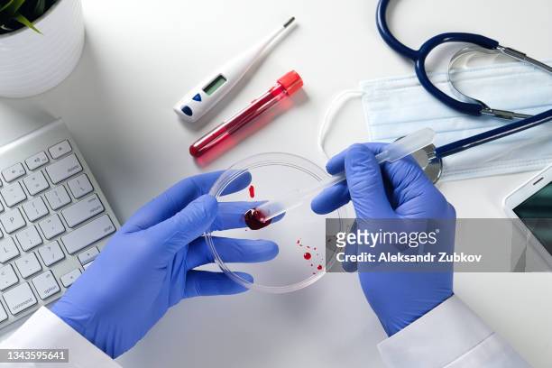 a doctor or laboratory assistant holds a petri dish with blood for medical examination, detection of antibodies to coronavirus and diseases. the concept of health and medicine, the development of a vaccine against diseases. - rubber gloves stockfoto's en -beelden
