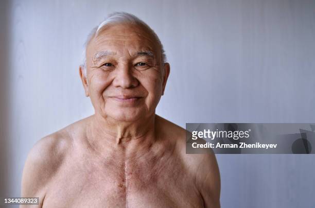senior man with with surgical scar on his chest - heart surgery scar stock pictures, royalty-free photos & images