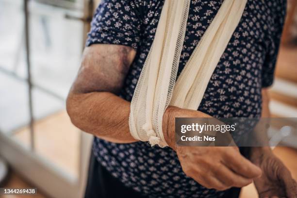 injury to a human hand - terrorismo imagens e fotografias de stock