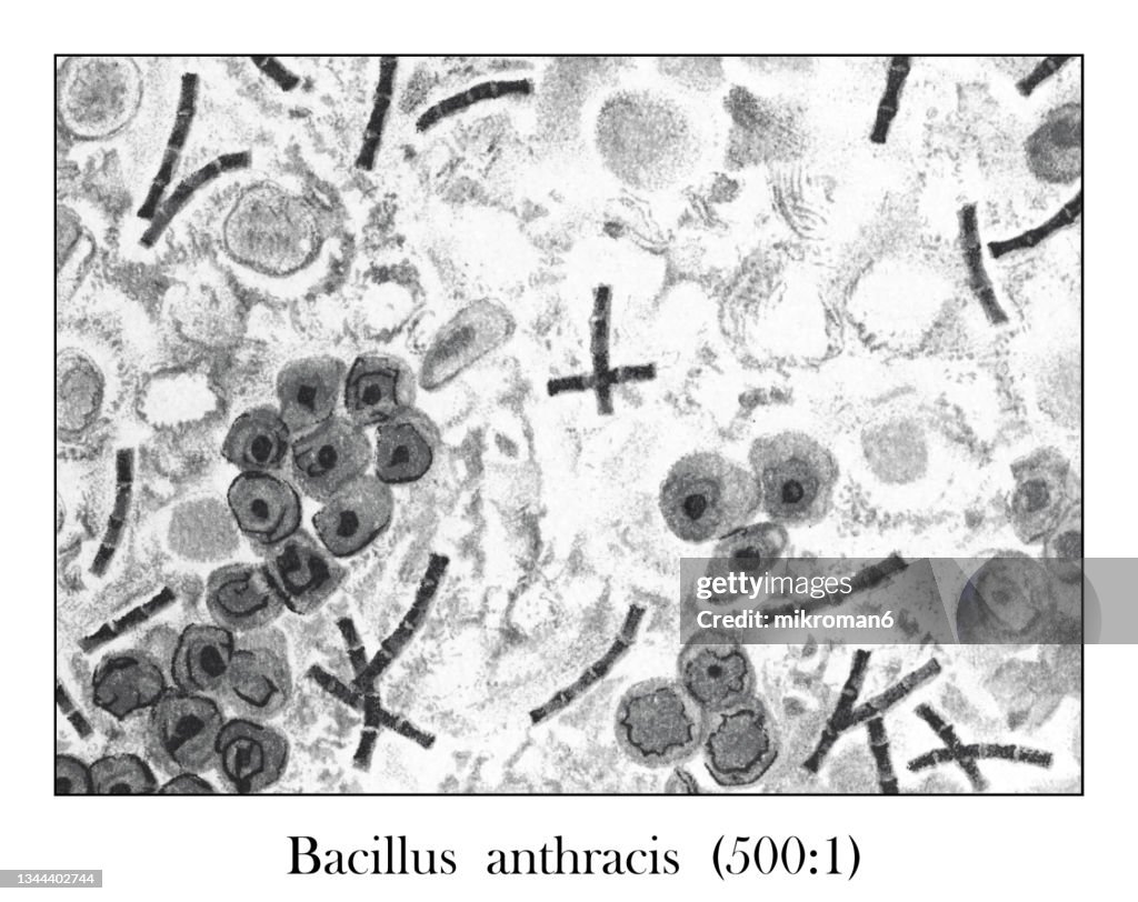 Old engraved illustration of Bacillus anthracis in the blood (500 : 1) under the microscope