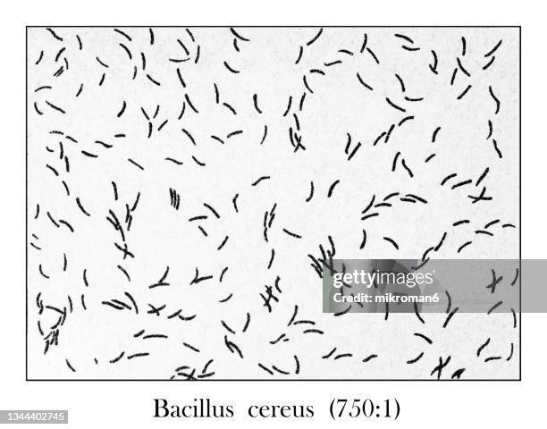 old engraved illustration of bacillus cereus pure culture from drinking water (750 : 1) under the microscope - cutaneous anthrax photos et images de collection