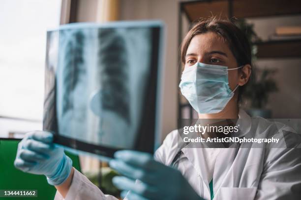 médico analisando imagem de raio-x pulmonar - pulmão-sistema-respiratório-humano - fotografias e filmes do acervo
