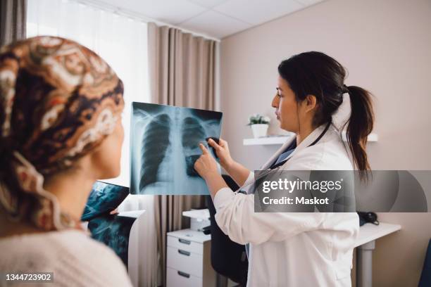 hispanic female expertise giving advice to cancer patient while examining x-ray at doctor's office - cancer treatment stock pictures, royalty-free photos & images