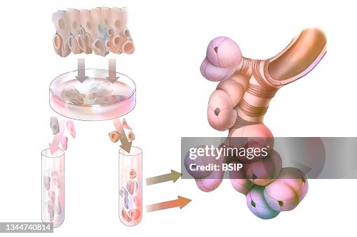 Cell Therapy Graphics Examples Cell Therapy Drawing High-Res Vector Graphic - Getty Images