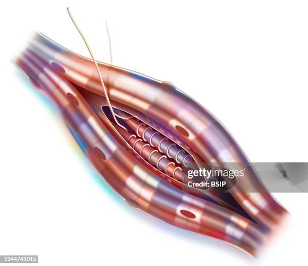 neuromuscular spindle - skeletal muscle stock illustrations