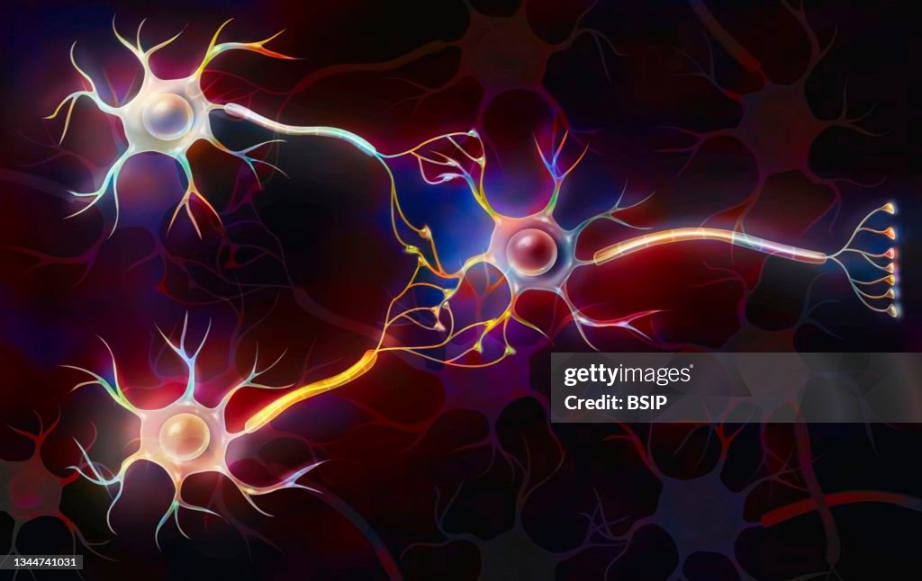 Nerve impulse drawing
