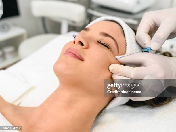 mesotherapy facelifting procedure - faden hände stock-fotos und bilder