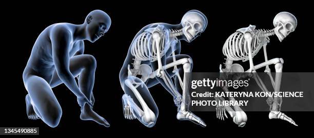 stockillustraties, clipart, cartoons en iconen met foot pain, illustration - human skeletal system