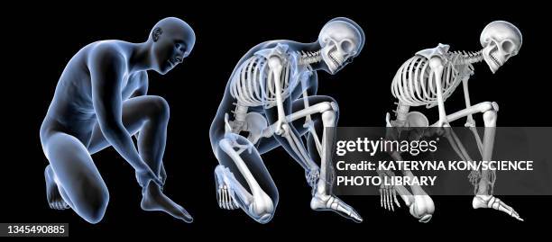 foot pain, illustration - cuneiform stock illustrations