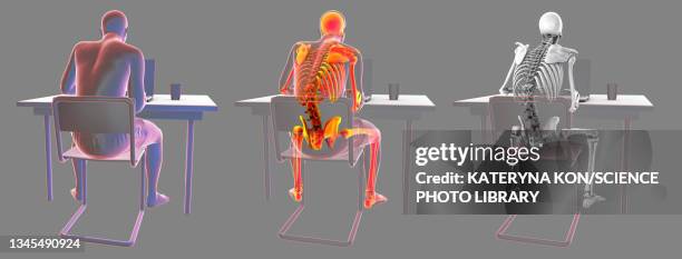 bad posture whilst using laptop, illustration - using laptop back stock illustrations