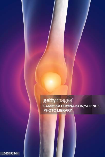 illustrazioni stock, clip art, cartoni animati e icone di tendenza di human knee pain, illustration - human joint