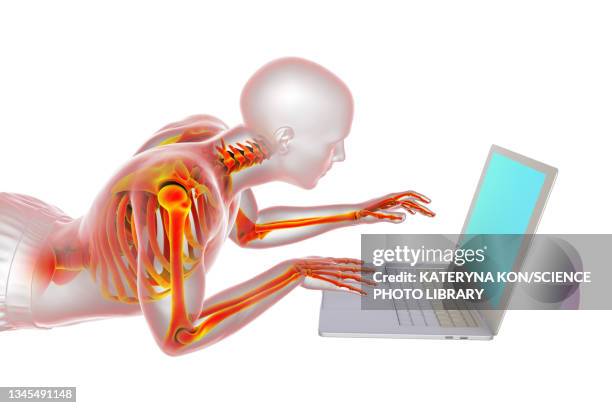 bad posture whilst using laptop, illustration - macbook laptop white background stock illustrations