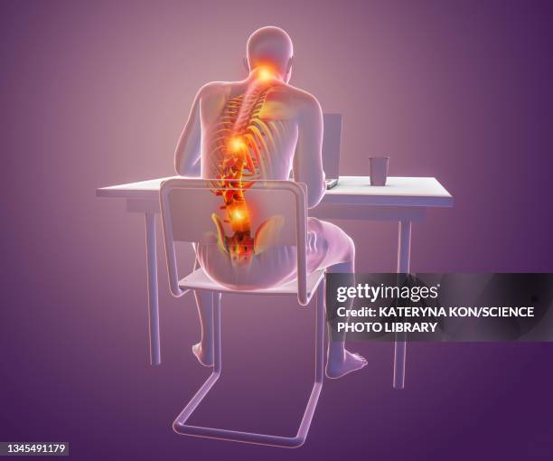 bad posture whilst using laptop, illustration - spine stock-grafiken, -clipart, -cartoons und -symbole