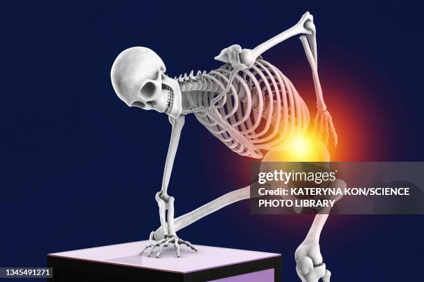 ilustrações de stock, clip art, desenhos animados e ícones de back pain, illustration - dor muscular