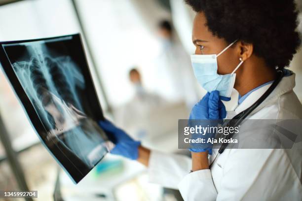 médico analizando una imagen de rayos x de un paciente con covid-19. - severe acute respiratory syndrome fotografías e imágenes de stock
