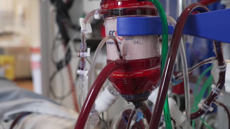 Ecmo Rig Ecmo Machine Videos and HD Footage - Getty Images