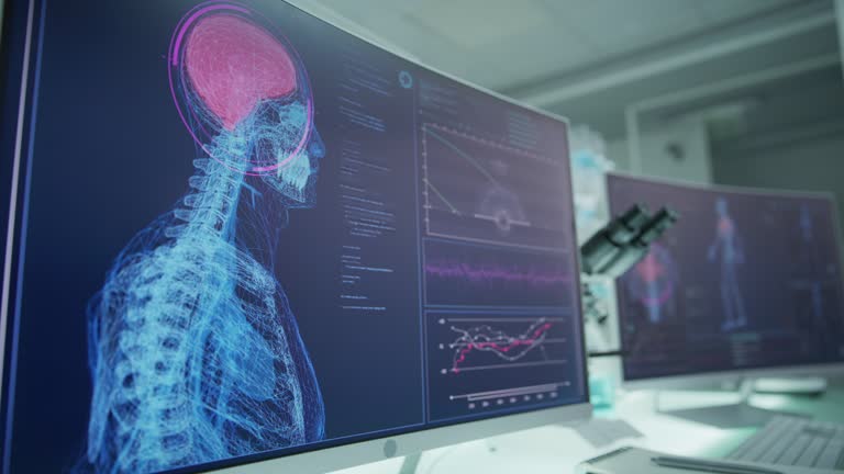 14 Brain Injury Cartoon Stock Videos, Footage, & 4K Video Clips - Getty ...