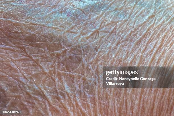 wrinkled and dry human skin - dry skin - fotografias e filmes do acervo