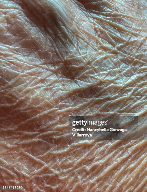 Early Old Dismisses Dry Skin Frequently Asked Questions