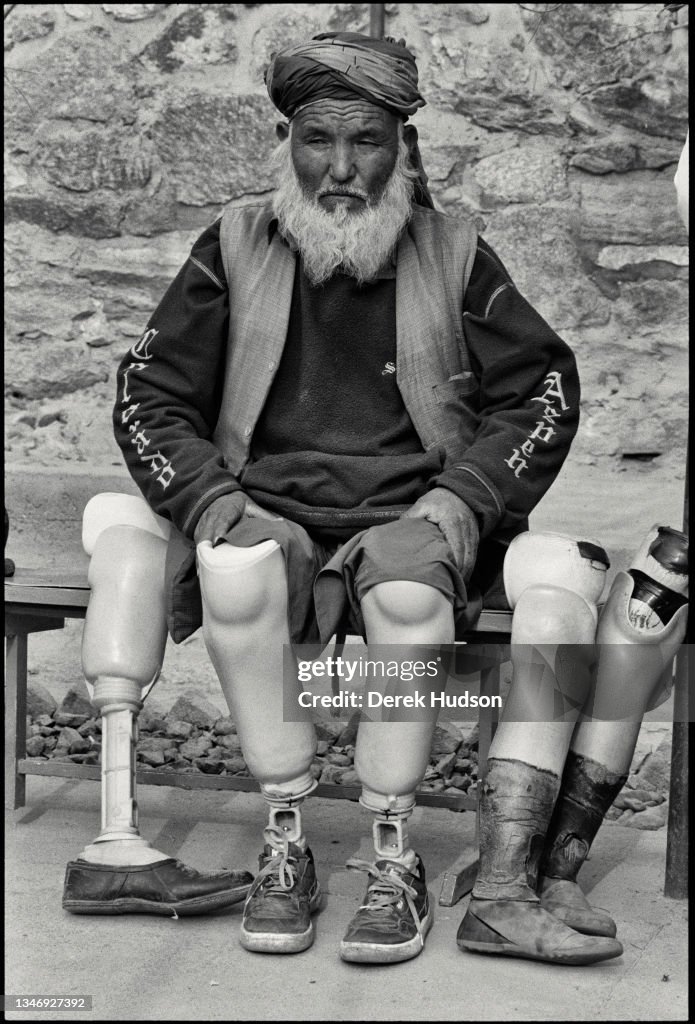 Patient At A Red Cross Orthopedic Center