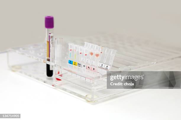 proben blut in reagenzglas im blood bank - blood group stock-fotos und bilder