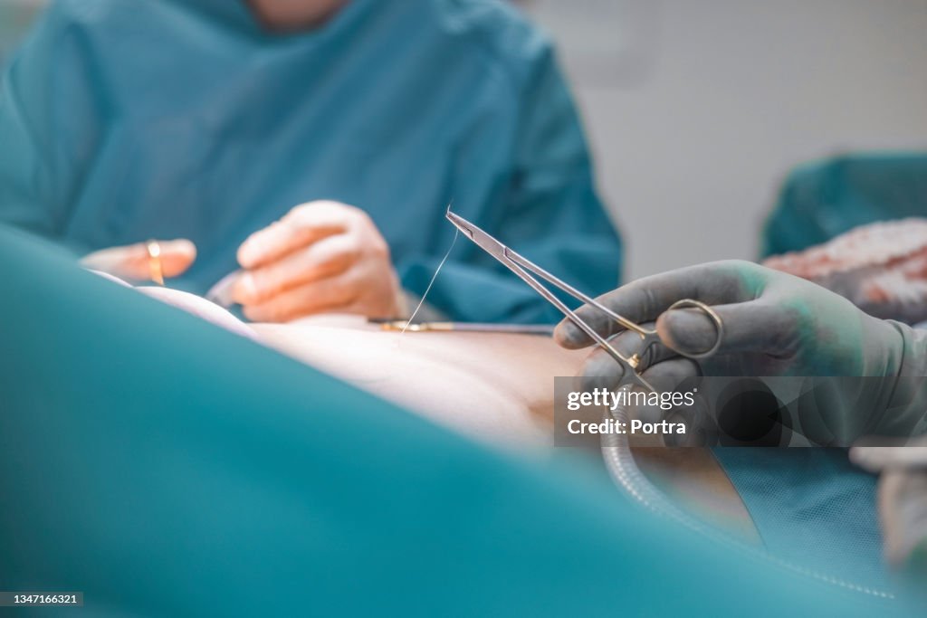 Team di medici che eseguono punti chirurgici