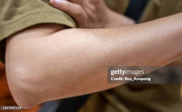 close up of woman arm with goosebumps on her skin. - piel de gallina fotografías e imágenes de stock