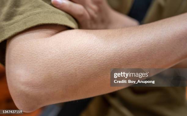 close up of woman arm with goosebumps on her skin. - goose bumps foto e immagini stock