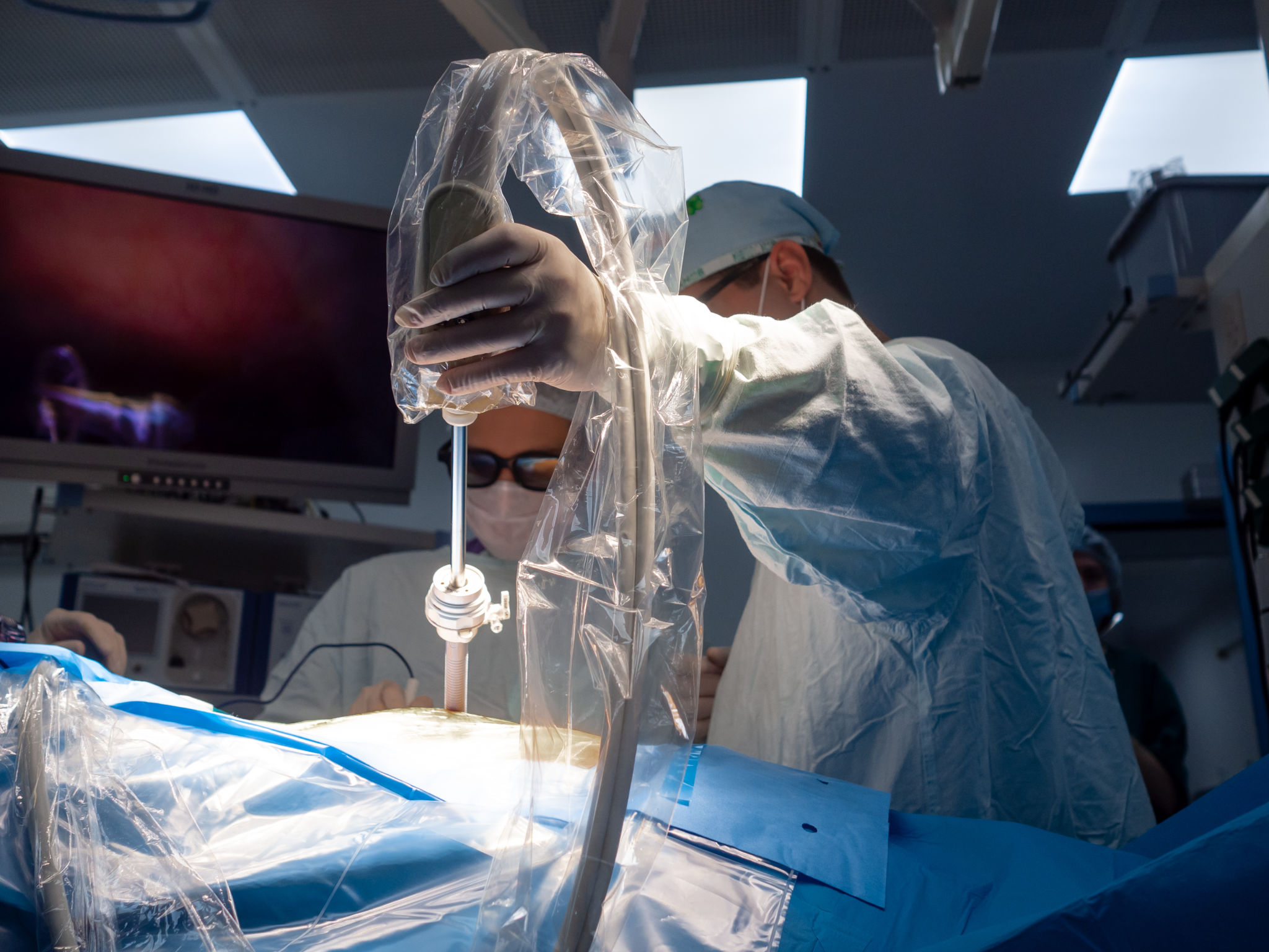 endosleeve surgery